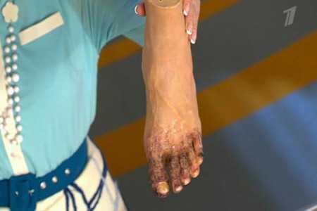 Человек держит пластмассовую ногу Человек держит пластмассовую ногу