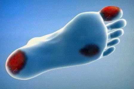 Больная нога Больная нога