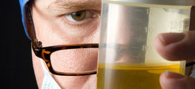 Результаты исследования диастазы мочи у взрослых при развитии панкреатита