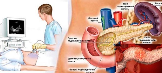 Причины увеличенного лимфоузла поджелудочной железы