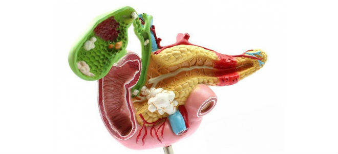 Камни в желчном пузыре и поджелудочной железе