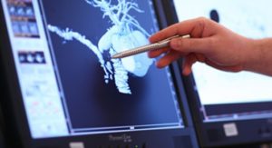 3d изображение, полученное с томографа