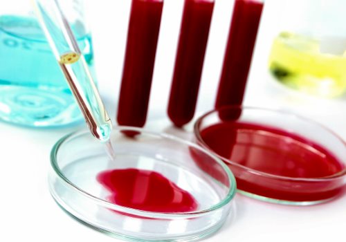 кровь на анализе