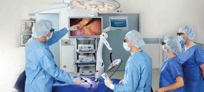 Проявления и развитие панкреатита после холецистэктомии