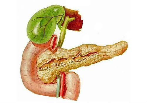 нерастворимые агрегаты в поджелудочной железе