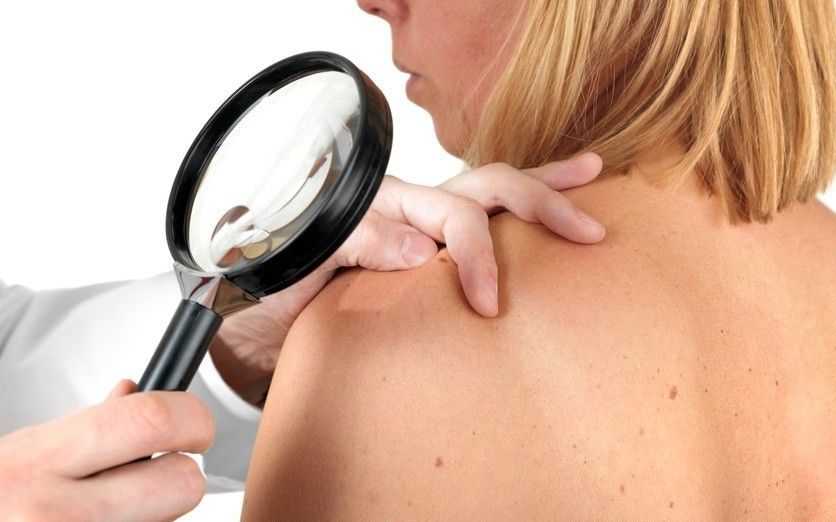 Заболевания кожи при диабете