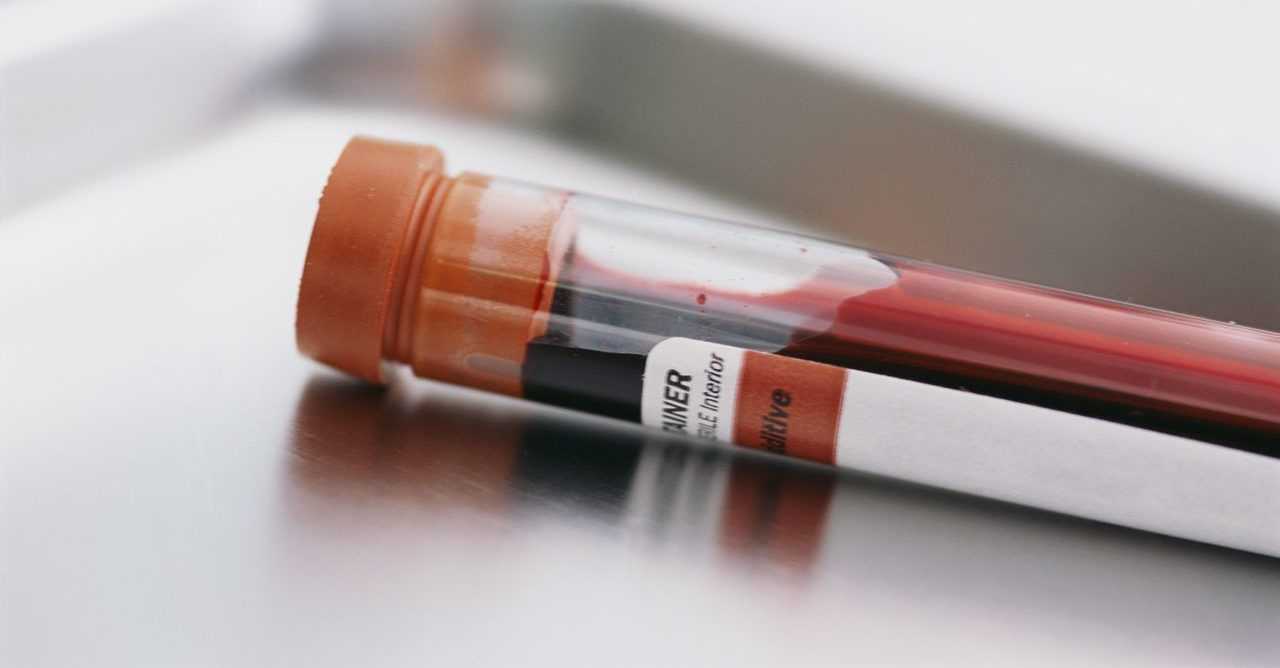 Биоматериал для анализа на сахар