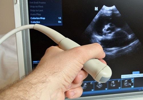 Аппарат УЗИ