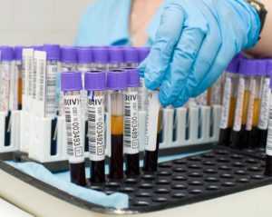 Биохимический анализ на глюкозу крови