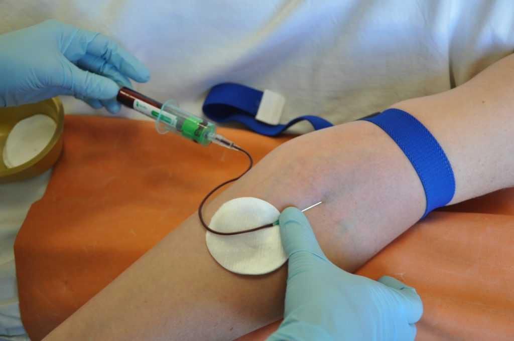 Показания к анализу