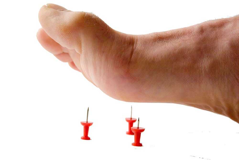 Диабетическая стопа