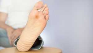 Диабетическая стопа симптомы и лечение