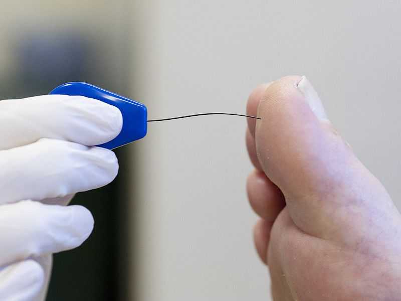 Симптомы и признаки