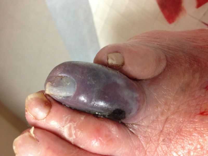 Чем это опасно