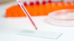 Избыток инсулина в крови