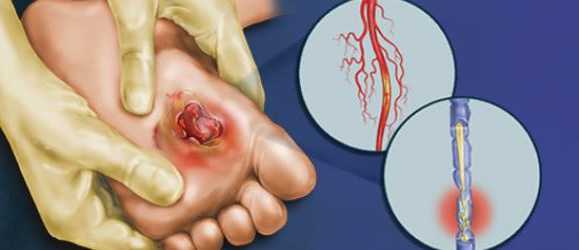 Какие могут быть осложнения