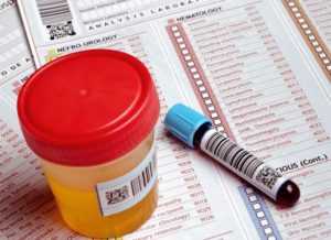 Какие анализы нужны при сахарном диабете