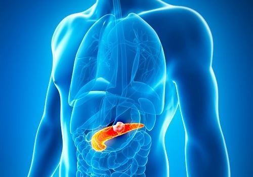 Киста поджелудочной железы