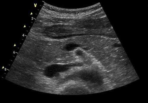 узи брюшной полости