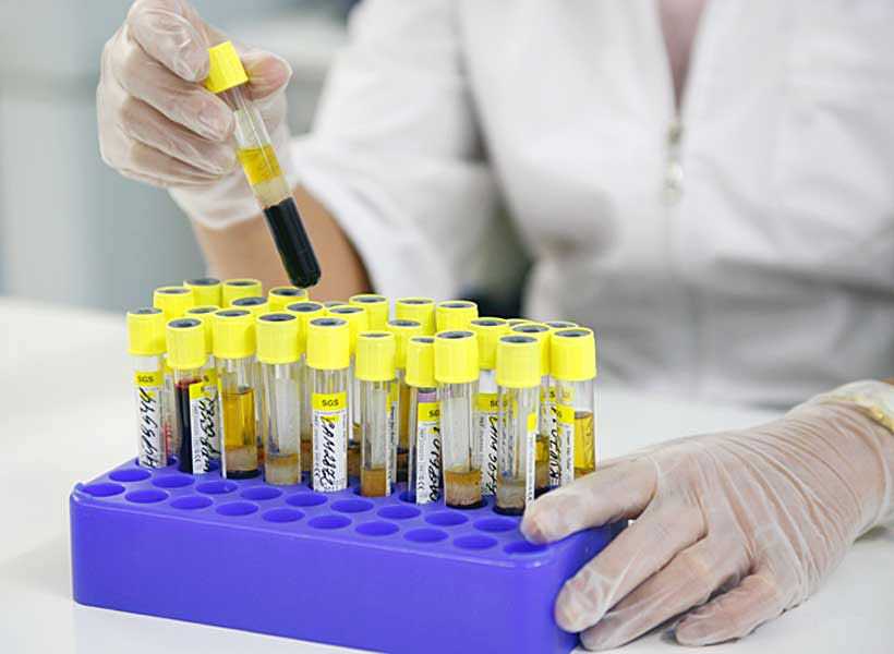 Норма инсулина у здорового человека