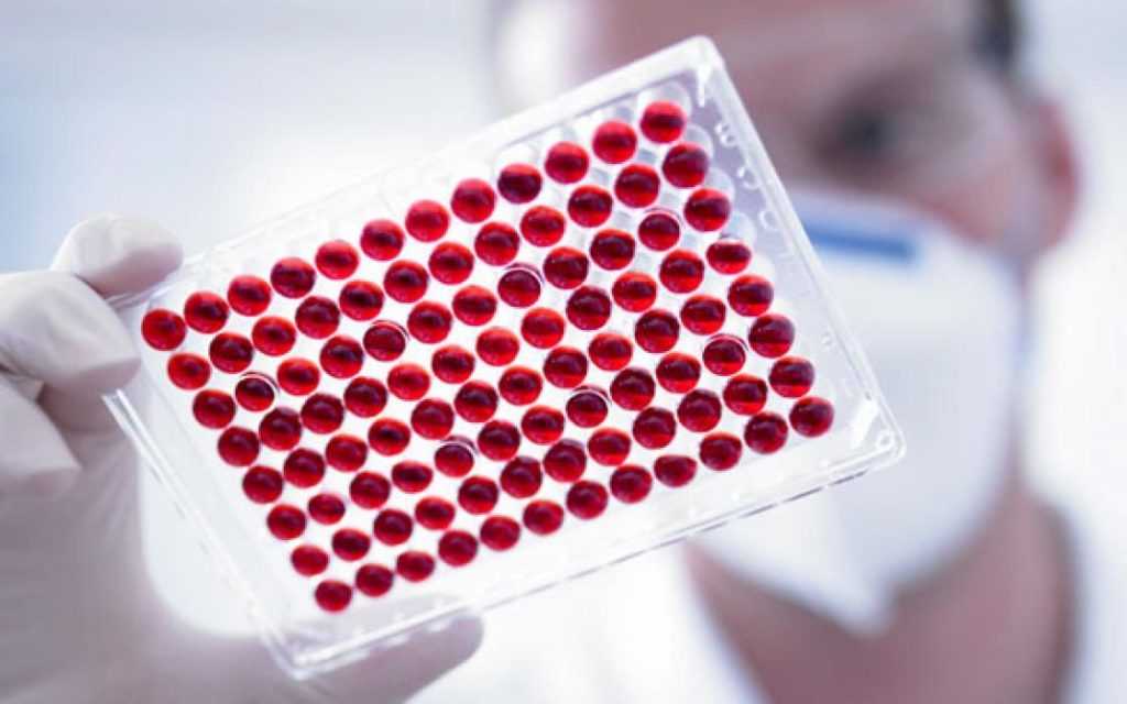 Норма глюкозы в крови у женщин