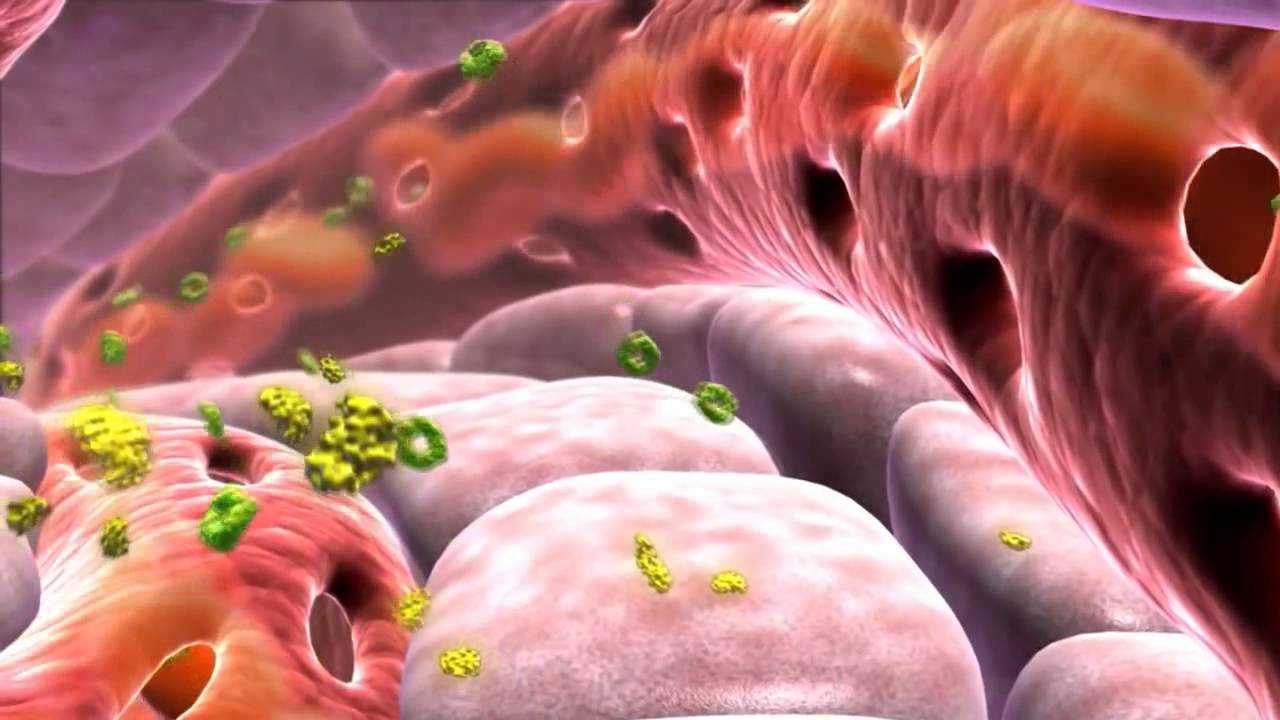 Осложнения диабета