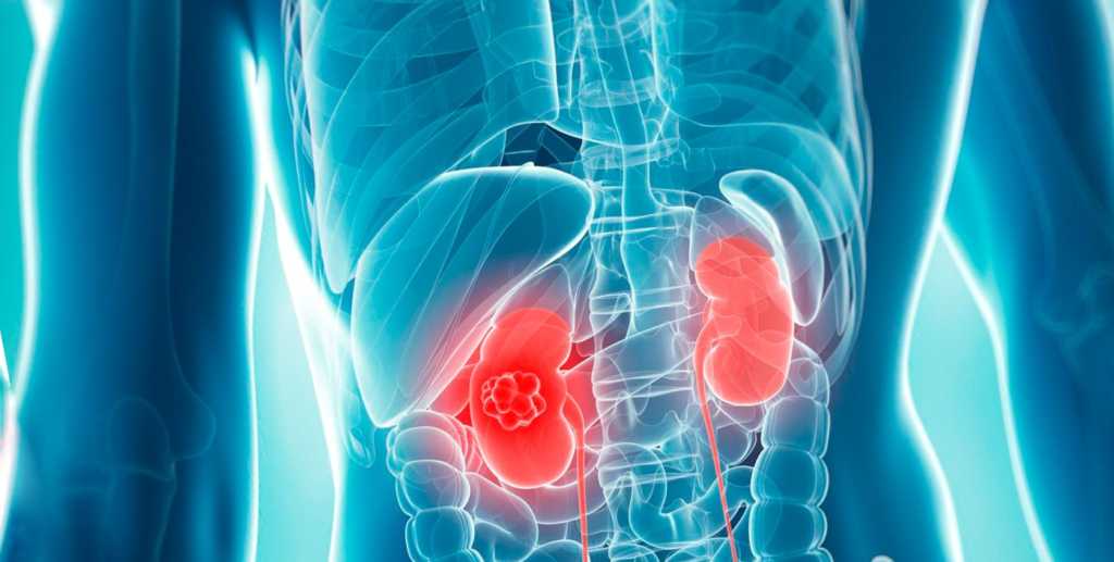 Срок жизни диабетиков 1 типа