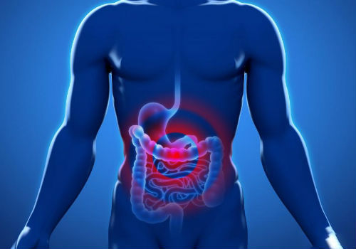 прогрессирование перитонита