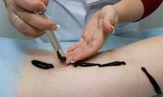 Подготовка пациента