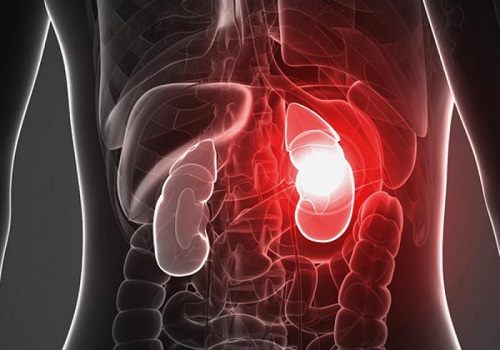 Полиорганная недостаточность