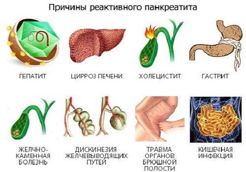 Причины панкреатита