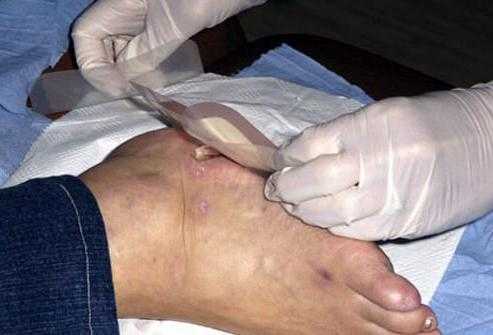 Профилактика