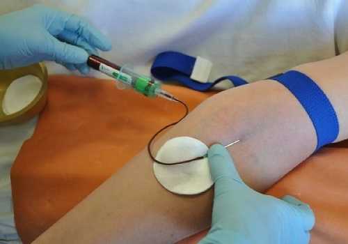 анализ крови из вены