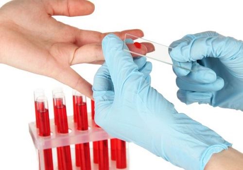 Сдавать кровь из пальца