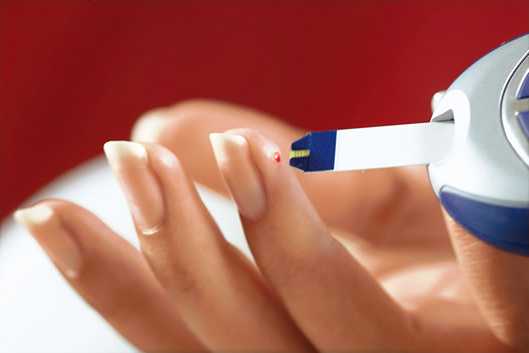 Симптомы сахарного диабета 2 типа у женщин