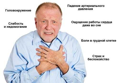 Тахикардия