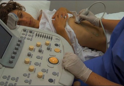 Врач делает УЗИ