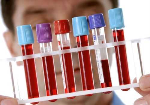 Пробирки с кровью