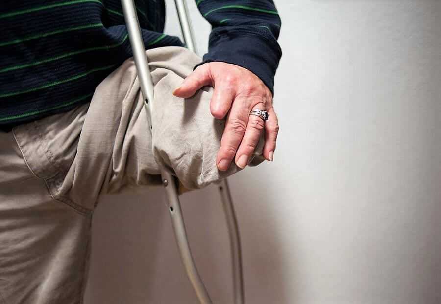 Гильотинная ампутация