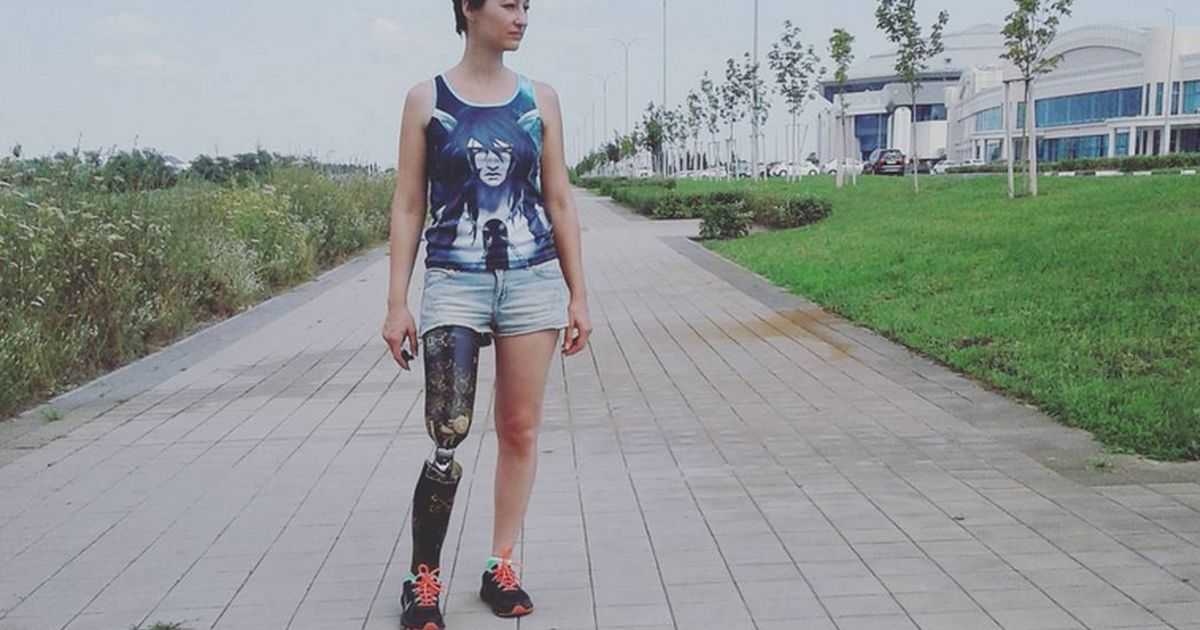 Ампутация ноги выше колена