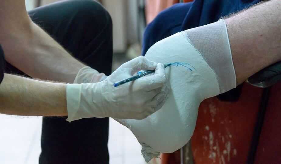 Причины ампутации