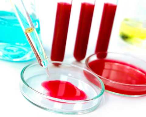 Анализ крови. Анализ крови.