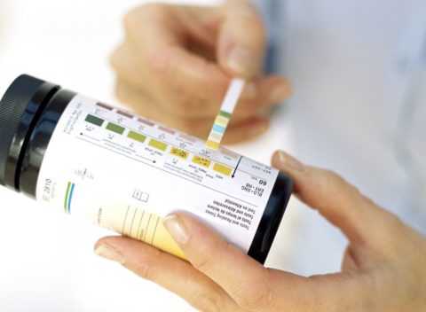 Анализ мочи на ацетон