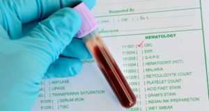 Откуда берут анализ на сахар (глюкозу)