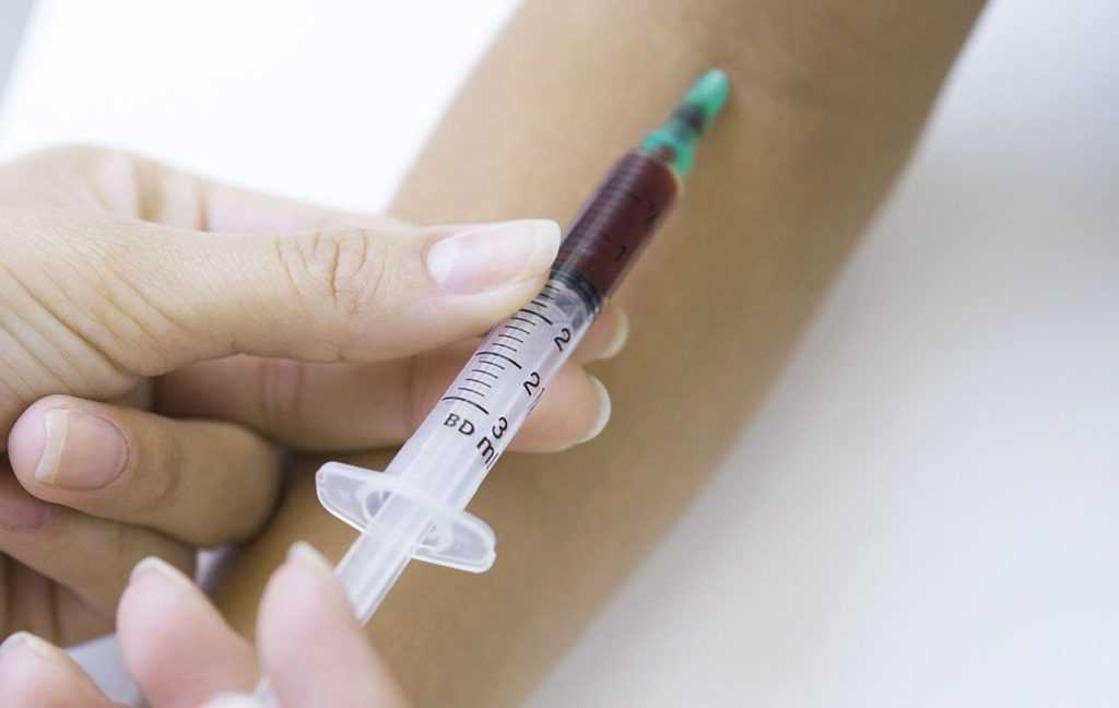 Как часто сдавать анализ на сахар