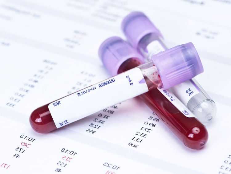 Уровень сахара в крови