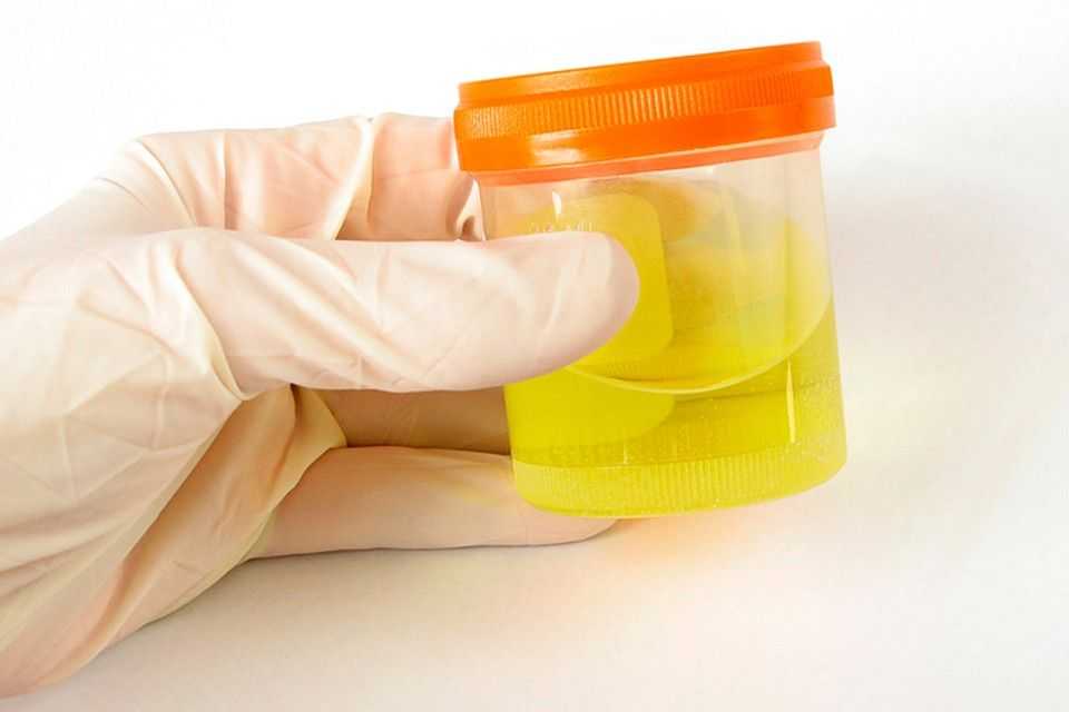 Как проходит анализ