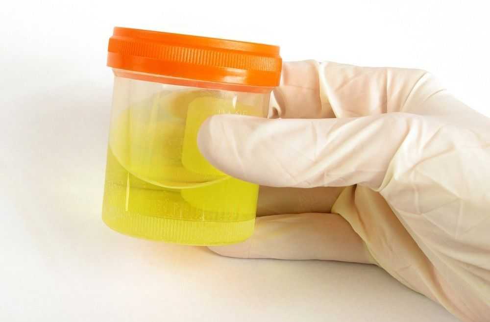 Расшифровка