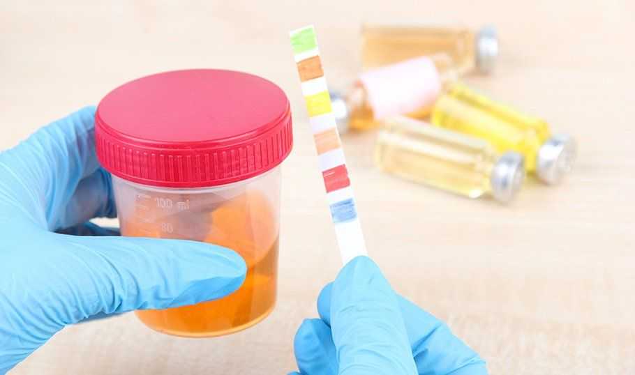 Повышенный сахар