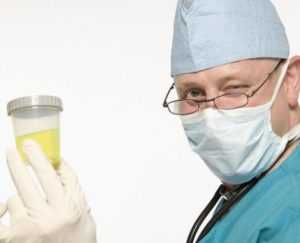 Норма сахара в моче